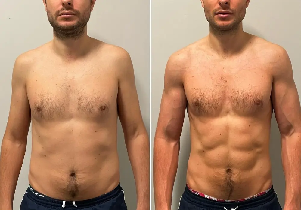 male-body-transformation-london-4.webp